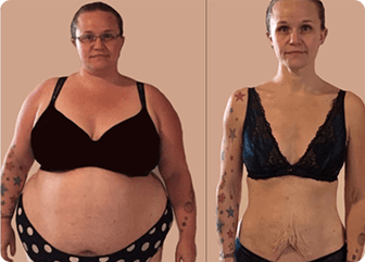 Jessica's before and after