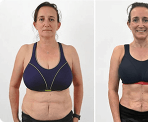 Michelle's before and after